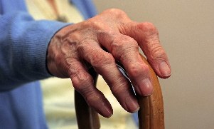 Arthrite et arthrose des doigts chez une personne âgée