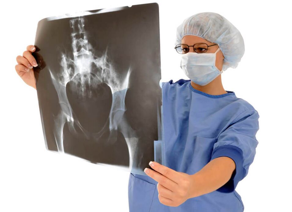 La radiographie de l'articulation de la hanche aidera le médecin à déterminer la cause de la douleur