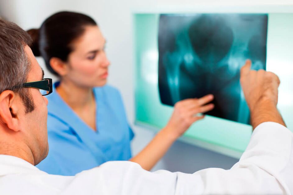Un rhumatologue ou un traumatologue diagnostique une douleur à l'articulation de la hanche. 